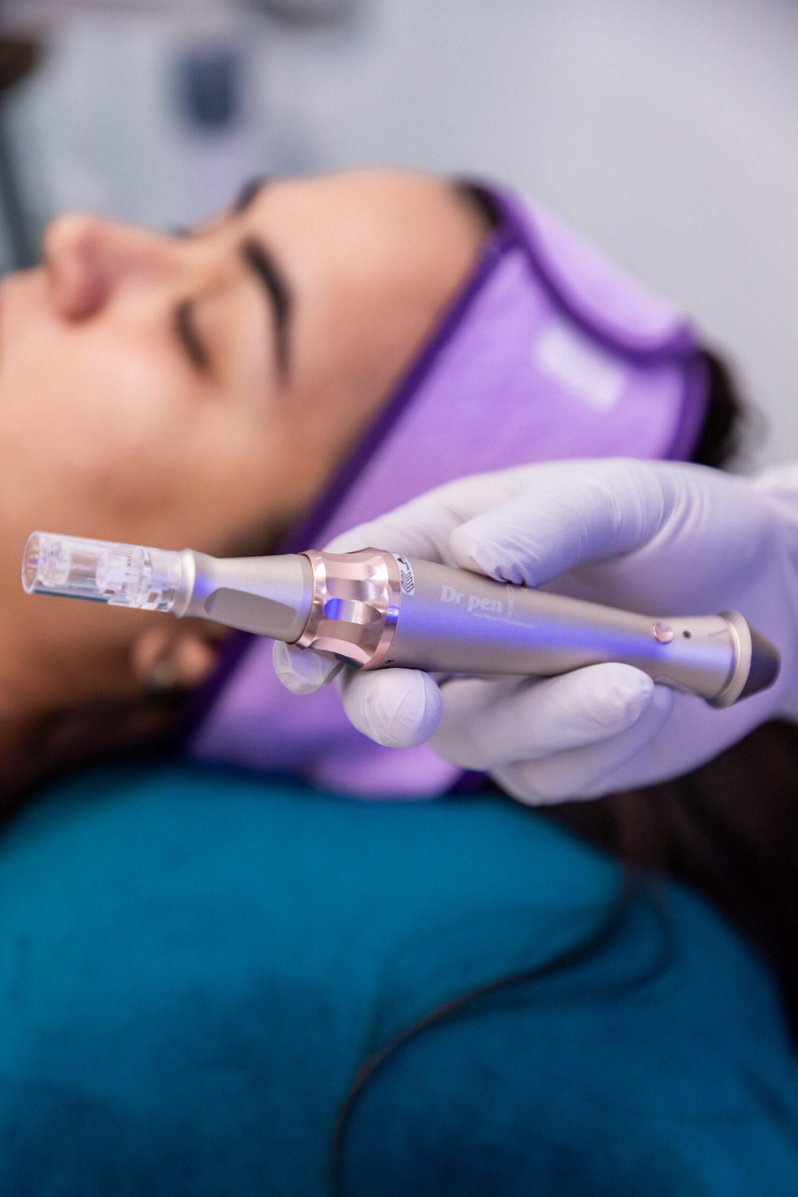 The Dermapen microneedling device's fine needles gently puncture the skin, stimulating collagen and elastin production to effectively reduce hyperpigmentation and stretch marks.