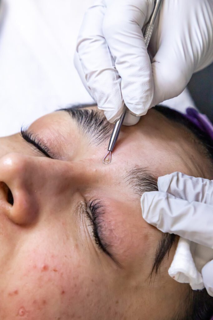 Experience the transformative benefits of our deep cleansing extraction facial. This targeted treatment focuses on removing blackheads, whiteheads, and other impurities that can contribute to acne and dullness.