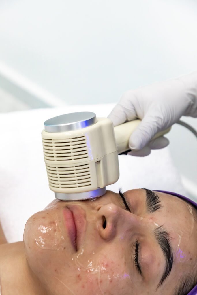 A woman with her eyes closed receiving a skin treatment on her face with a medical device at Vanitya Aesthetics.