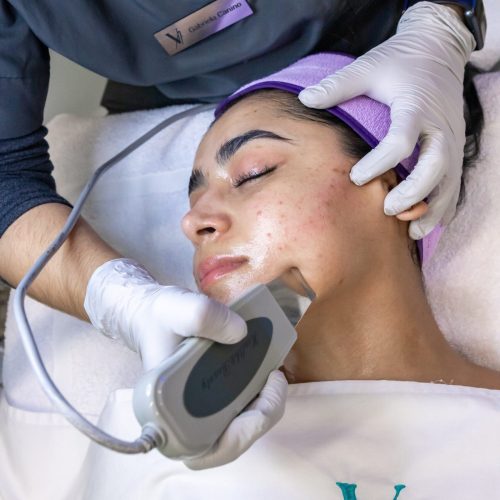 Microderm Facial Cancun MX