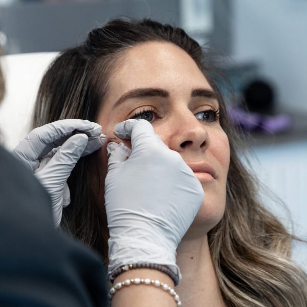 A syringe filled with hyaluronic acid filler, commonly used for lip injections and under-eye filler treatments.